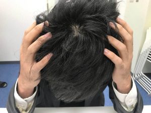 失敗